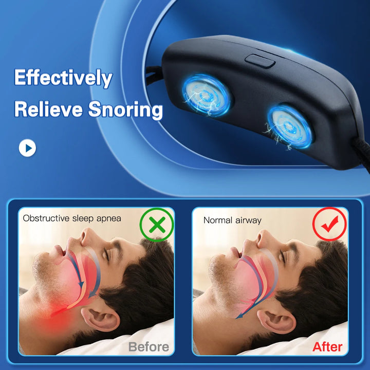 AI Calm Breath Pro® – Smart Anti-Snoring Device – Comfortable, Portable Sleep Aid