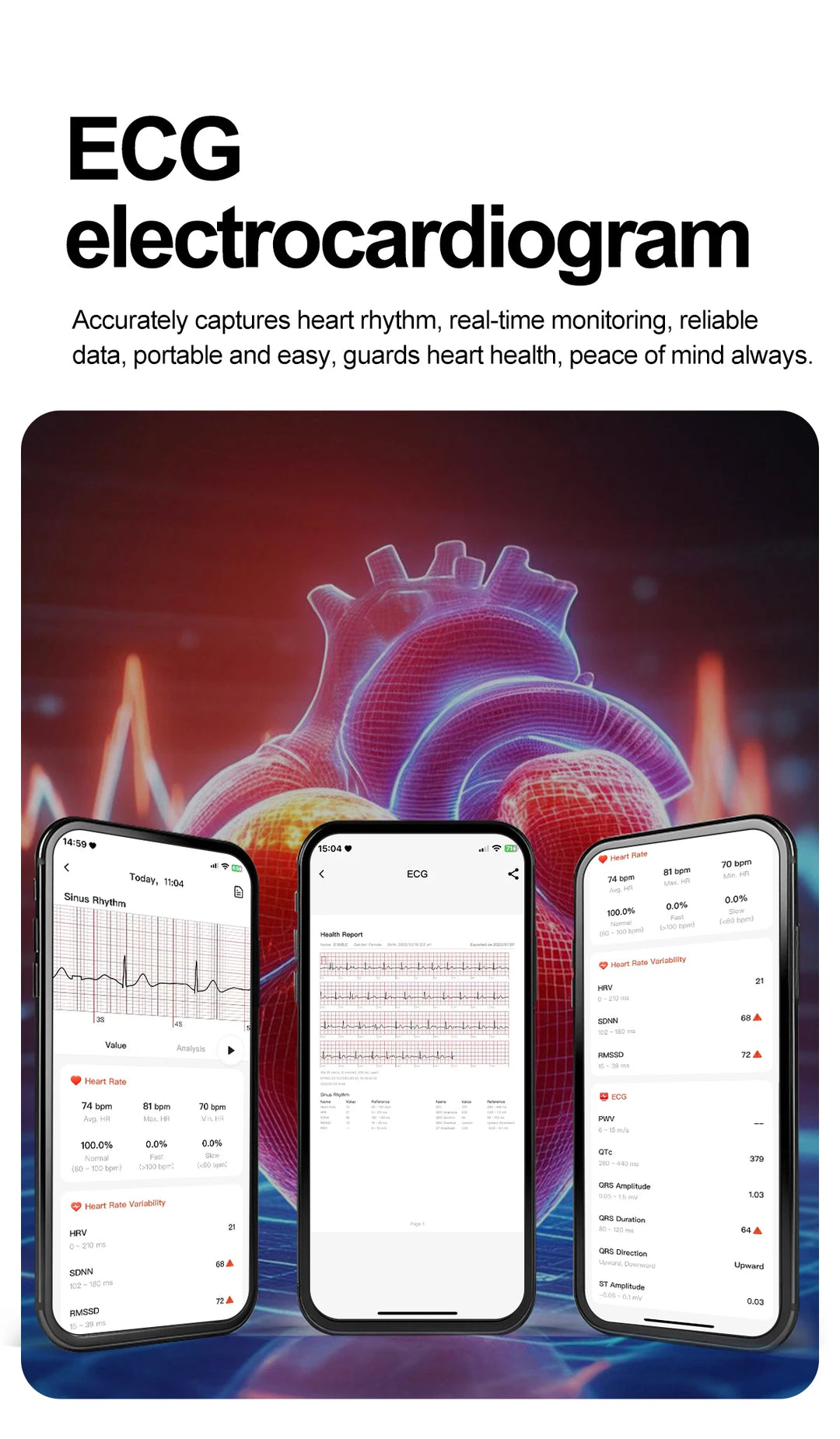 2025 New AI Intelligent ECG Health Smartwatches Men Blood Lipids Uric Acid Heart Rate 2.5D Dynamic UI Bluetooth Call Smart Watch