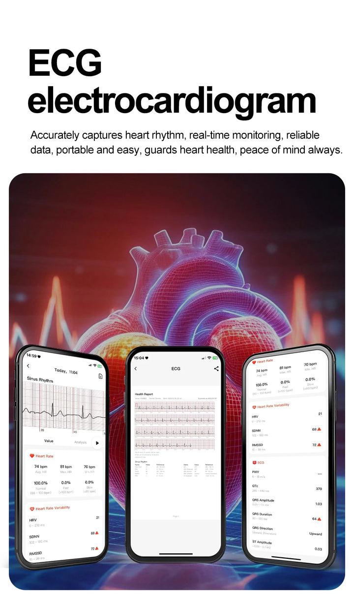 2025 New AI Intelligent ECG Health Smartwatches Men Blood Lipids Uric Acid Heart Rate 2.5D Dynamic UI Bluetooth Call Smart Watch